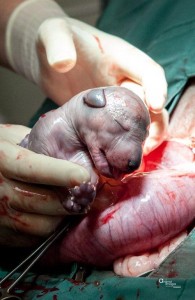 DA Birth